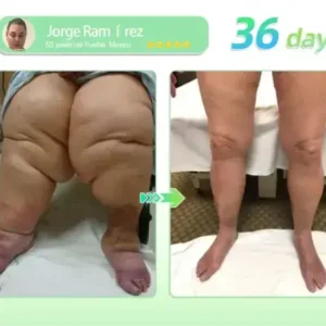 𝐆𝐋𝐏-𝟏 𝑺𝑰𝑿-𝑰𝑵-𝑶𝑵𝑬 𝑯𝒆𝒂𝒍𝒕𝒉 𝑺𝒐𝒍𝒖𝒕𝒊𝒐𝒏 𝑶𝒓𝒂𝒍 𝑳𝒊𝒒𝒖𝒊𝒅