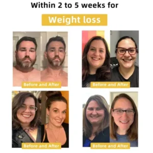 𝐁𝐞𝐞 𝐕𝐞𝐧𝐨𝐦 𝐃𝐞𝐭𝐨𝐱 𝐄𝐥𝐢𝐱𝐢𝐫 – 𝐋𝐢𝐩𝐨𝐭𝐫𝐨𝐩𝐢𝐜 & 𝐅𝐢𝐫𝐦𝐢𝐧𝐠 𝐃𝐮𝐨