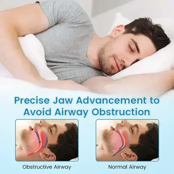 Anti-Snoring & Anti-Grinding Teeth Protector