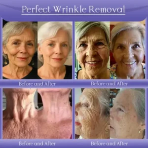 Anti-Wrinkle Skin Cream for Remove Wrinkles