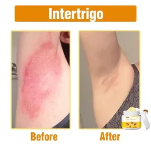 Bee Venom Comprehensive Cream