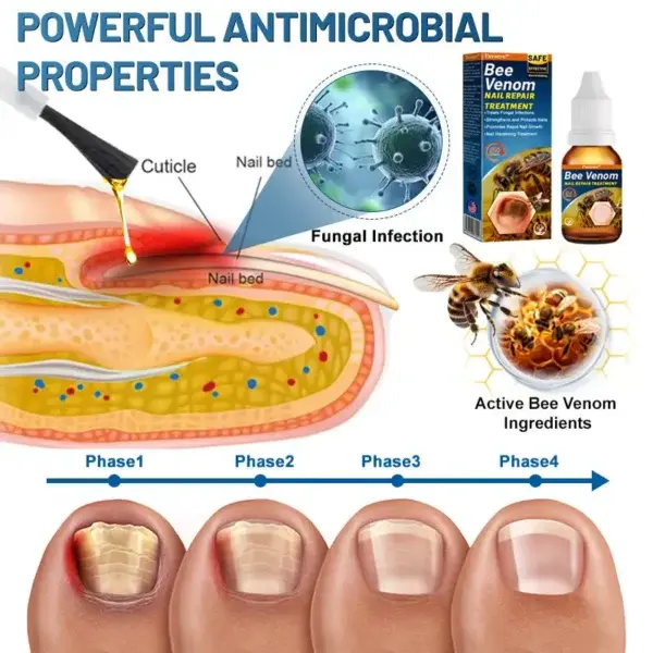 Bee Venom Nail Repair Treatment