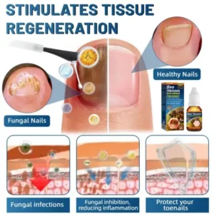 Bee Venom Nail Repair Treatment