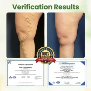 Lymphatic Detox Herbal Cream