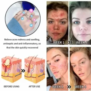 Lymphatic Magnetic Therapy Diamond Ring