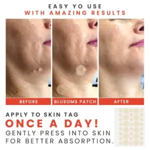 MicroDarts TAG’Gone Patch