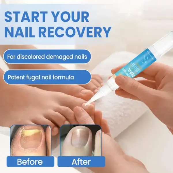 MycoErase Nail Revive Pen