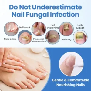 MycoErase Nail Revive Pen