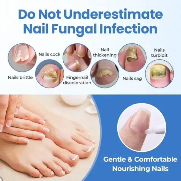 MycoErase Nail Revive Pen