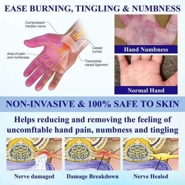 NumbAway CoolEase Neuropathy Spray