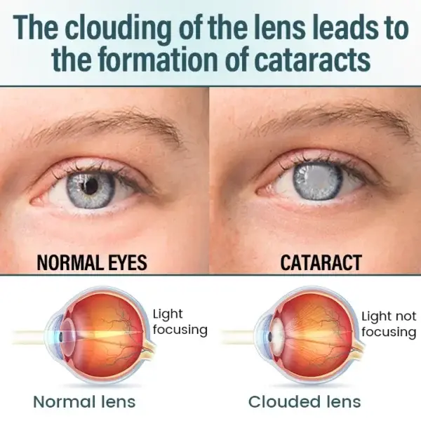 OptiFusion Nano Eye Drops Serum