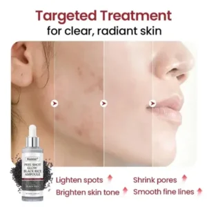 Peel Shot Glow Black Rice Ampoule