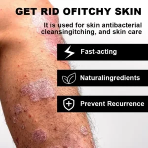 Psoriasis Cure Cream