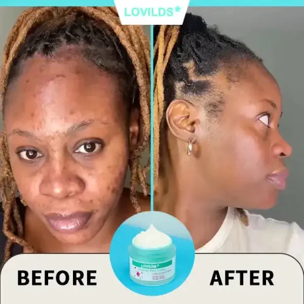 Renewal Skin Cream