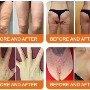 Royal Jelly Moisturizing Lifting Cream