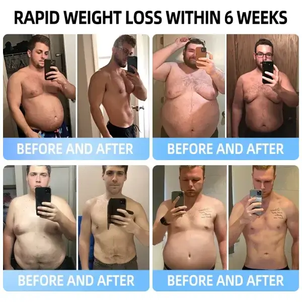 SMGT-GLP-1 Nano Microneedle Patch