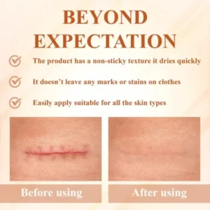 SiliconeFoam Healing Pads