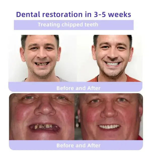 TeethRestoration Mineral Powder