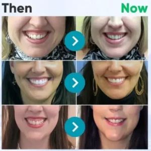 VioGloss Bienengift-Zahntherapie Oral Power