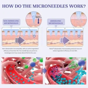 ๐ก๐ฎ๐ป๐ผ ๐ ๐ถ๐ฐ๐ฟ๐ผ๐ป๐ฒ๐ฒ๐ฑ๐น๐ฒ ๐ฃ๐ฎ๐๐ฐ๐ต