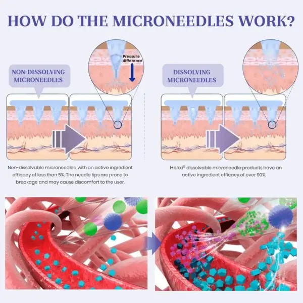 ๐ก๐ฎ๐ป๐ผ ๐ ๐ถ๐ฐ๐ฟ๐ผ๐ป๐ฒ๐ฒ๐ฑ๐น๐ฒ ๐ฃ๐ฎ๐๐ฐ๐ต