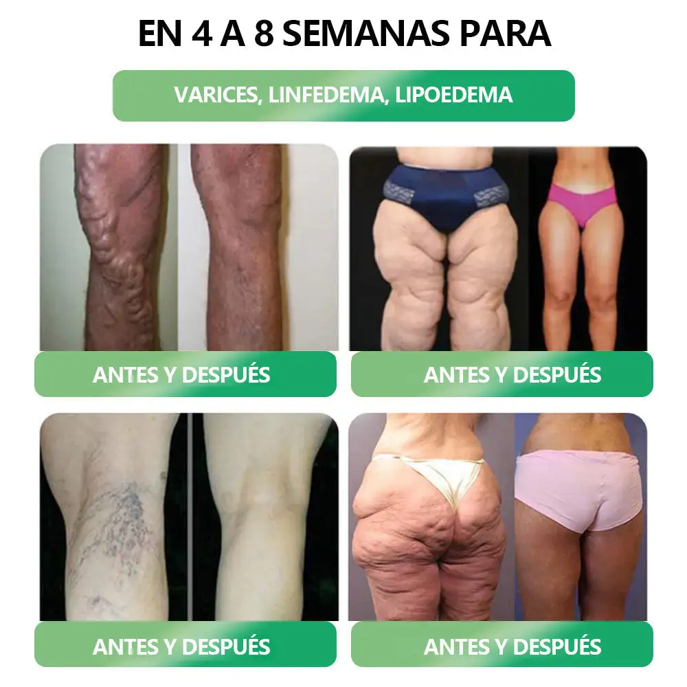 ๐ฎ๐ฌ-๐๐-๐ญ ๐๐จ๐ฅ๐ฎ๐๐ข๐จฬ๐ง ๐ฉ๐๐ซ๐ ๐ฅ๐ ๐ฌ๐๐ฅ๐ฎ๐ ๐๐ขฬ๐ช๐ฎ๐ข๐๐จ ๐จ๐ซ๐๐ฅ - Image 6