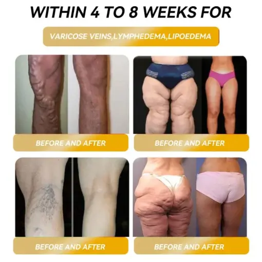 ๐๐๐ ๐ง๐๐ญ๐ข๐ ๐๐ง๐๐ซ๐ ๐ฒ ๐๐-๐๐ญ๐จ๐ง๐ ๐๐๐ฉ๐ฅ๐ ๐๐๐ซ๐ซ๐ข๐ง๐ ๐ฌ - Image 2