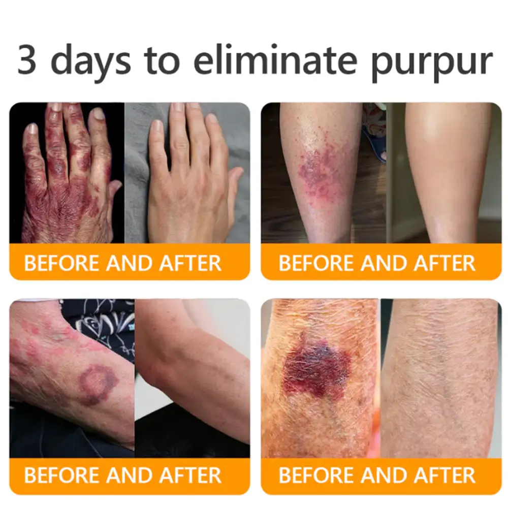 ๐๐๐ฅ๐ฅ๐จ๐ฐ ๐๐๐ ๐๐๐ง๐จ๐ฆ ๐๐ค๐ข๐ง ๐๐๐ฌ๐ญ๐จ๐ซ๐๐ญ๐ข๐จ๐ง ๐๐ซ๐๐๐ฆ - Image 2