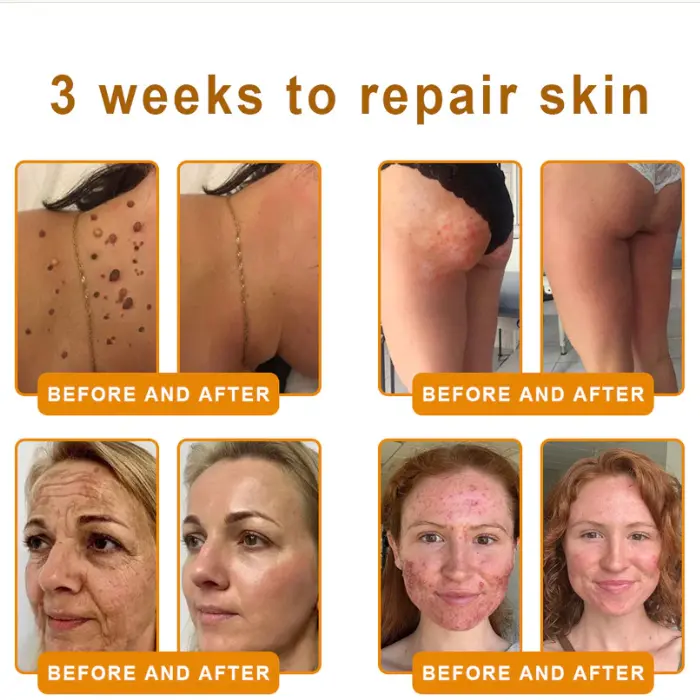 ๐๐๐ฅ๐ฅ๐จ๐ฐ ๐๐๐ ๐๐๐ง๐จ๐ฆ ๐๐ค๐ข๐ง ๐๐๐ฌ๐ญ๐จ๐ซ๐๐ญ๐ข๐จ๐ง ๐๐ซ๐๐๐ฆ - Image 3