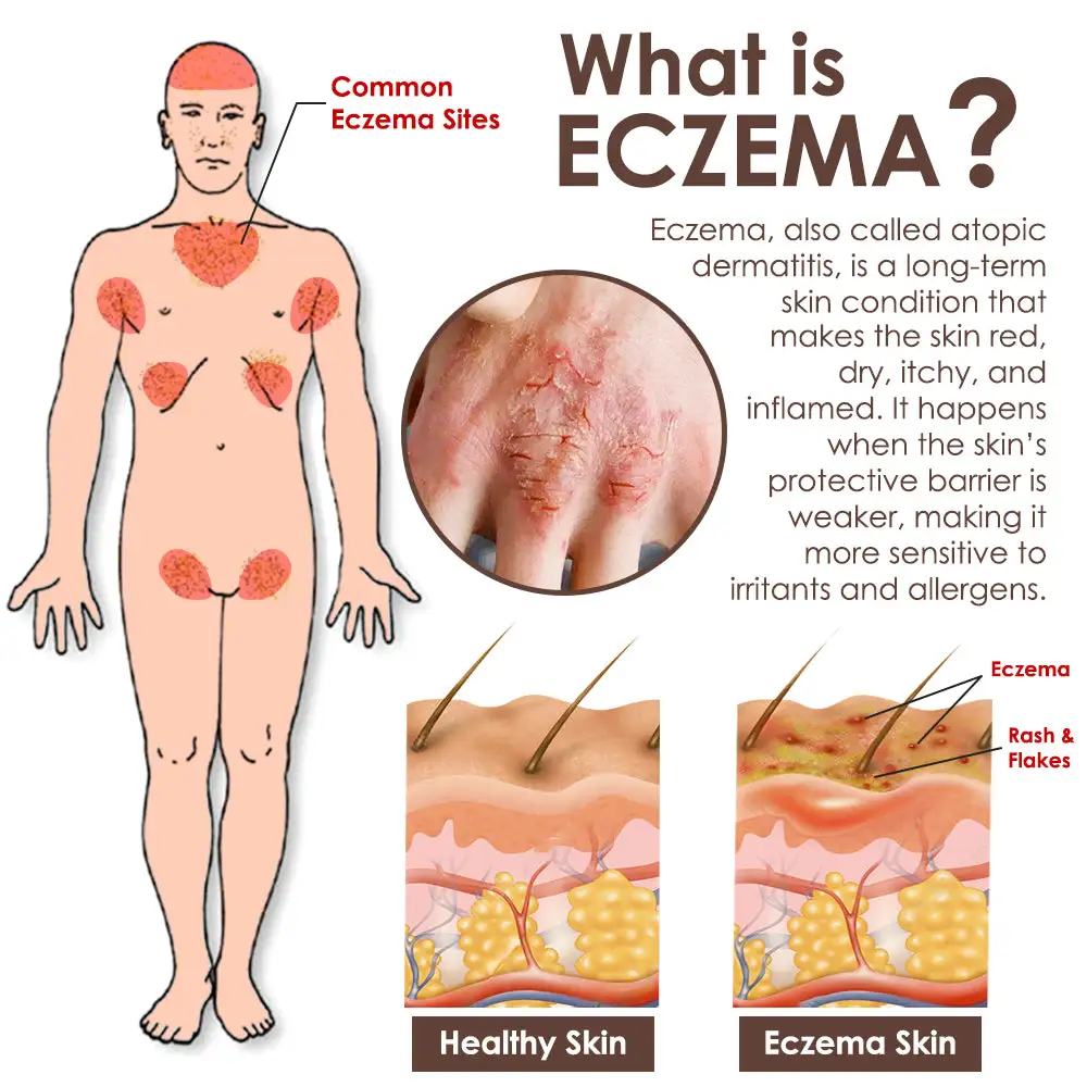 ๐๐๐ฅ๐ฅ๐จ๐ฐ ๐๐๐ ๐๐๐ง๐จ๐ฆ ๐๐ค๐ข๐ง ๐๐๐ฌ๐ญ๐จ๐ซ๐๐ญ๐ข๐จ๐ง ๐๐ซ๐๐๐ฆ - Image 5