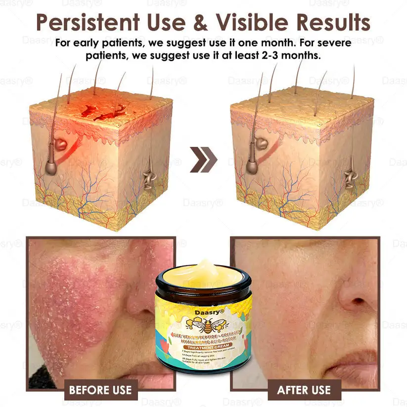 ๐๐๐ฅ๐ฅ๐จ๐ฐ ๐๐๐ ๐๐๐ง๐จ๐ฆ ๐๐ค๐ข๐ง ๐๐๐ฌ๐ญ๐จ๐ซ๐๐ญ๐ข๐จ๐ง ๐๐ซ๐๐๐ฆ - Image 6