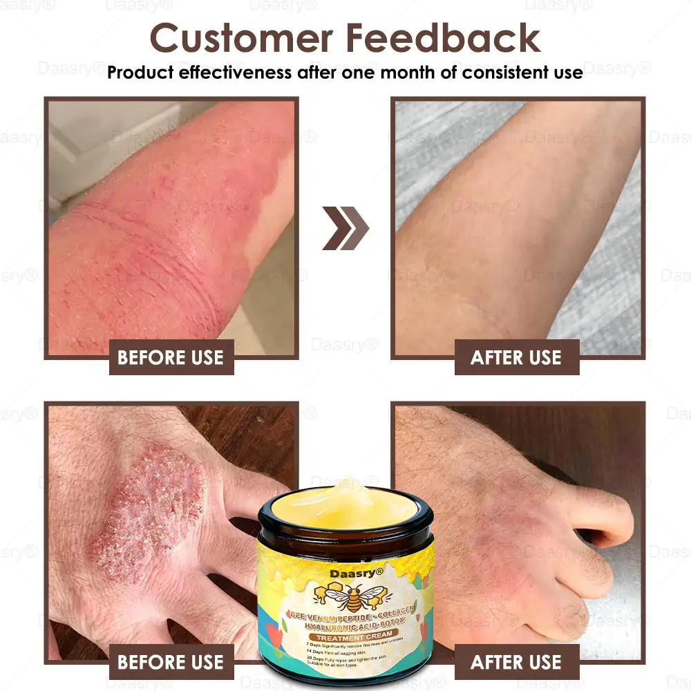 ๐๐๐ฅ๐ฅ๐จ๐ฐ ๐๐๐ ๐๐๐ง๐จ๐ฆ ๐๐ค๐ข๐ง ๐๐๐ฌ๐ญ๐จ๐ซ๐๐ญ๐ข๐จ๐ง ๐๐ซ๐๐๐ฆ - Image 8