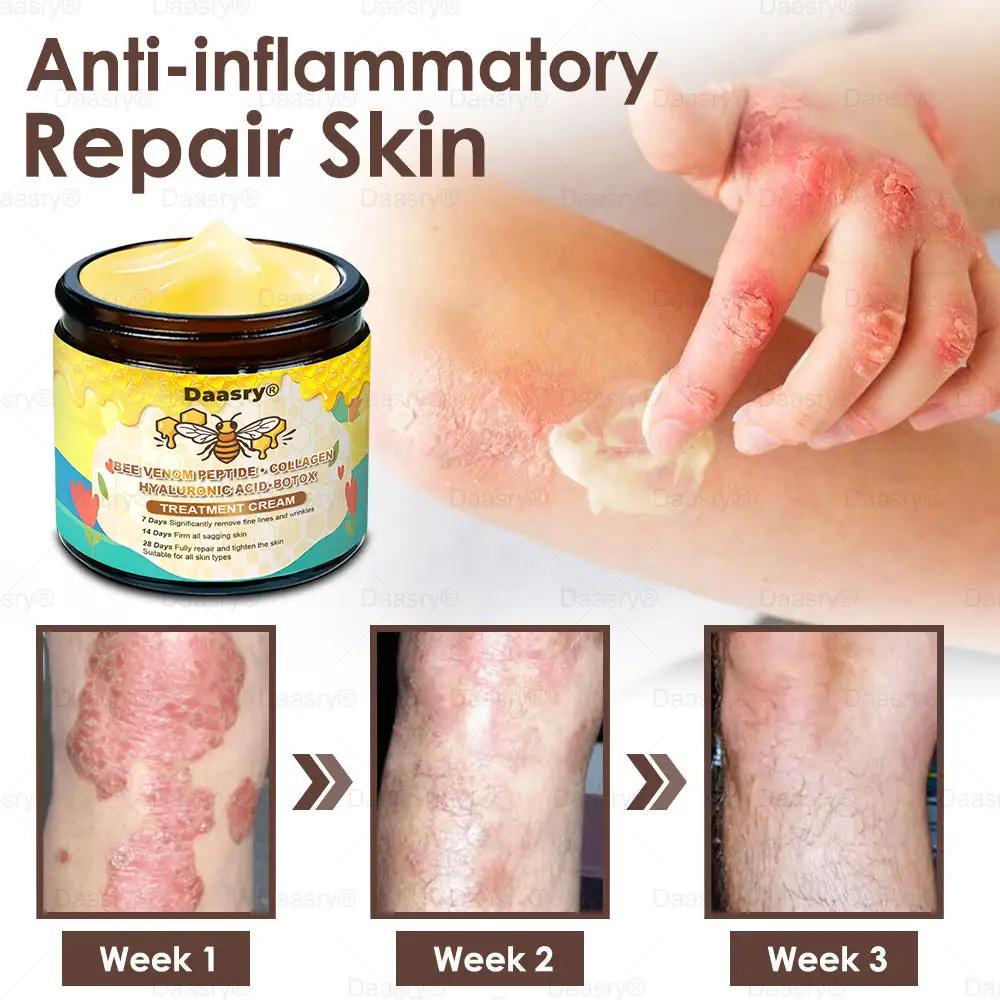 ๐๐๐ฅ๐ฅ๐จ๐ฐ ๐๐๐ ๐๐๐ง๐จ๐ฆ ๐๐ค๐ข๐ง ๐๐๐ฌ๐ญ๐จ๐ซ๐๐ญ๐ข๐จ๐ง ๐๐ซ๐๐๐ฆ - Image 9