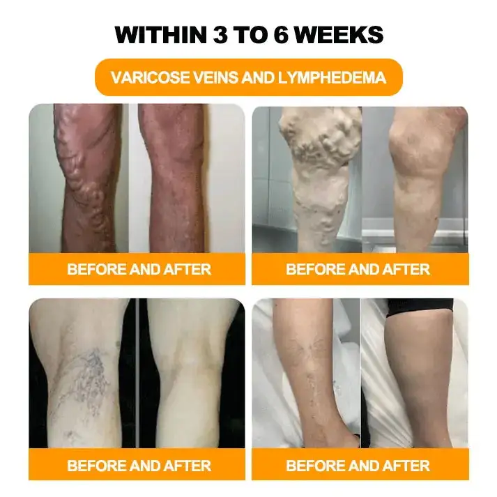 ๐๐๐ ๐๐๐ง๐จ๐ฆ & ๐๐-๐๐๐ซ๐ ๐๐๐ญ๐จ๐ฑ ๐
๐จ๐จ๐ญ ๐๐จ๐๐ค ๐๐๐๐๐ฌ ๐๐จ๐ซ ๐๐จ๐๐ฒ ๐๐๐ฎ๐ฅ๐ฉ๐ญ๐ข๐ง๐ - Image 3