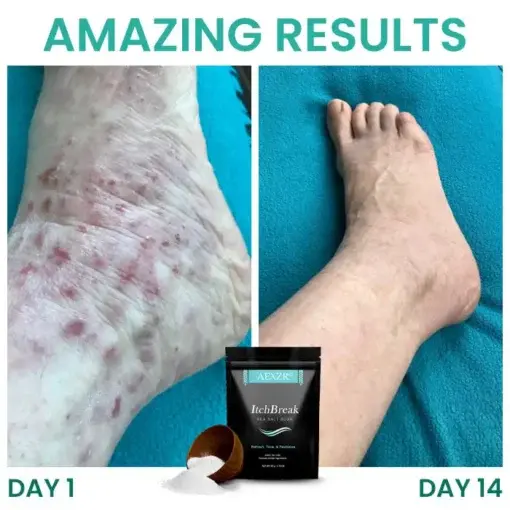 ItchBreak Sea Salt Soak - Image 6