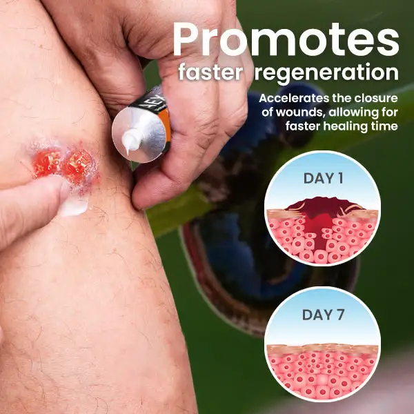 Diabetic Wound Leech Cure Cream - Image 5