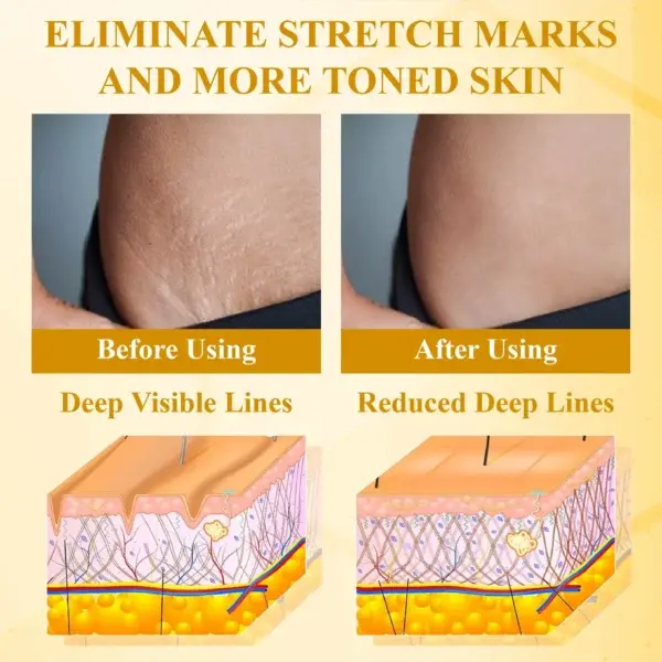 BotoxBee Advanced Multi-Action FirmingCream - Image 10