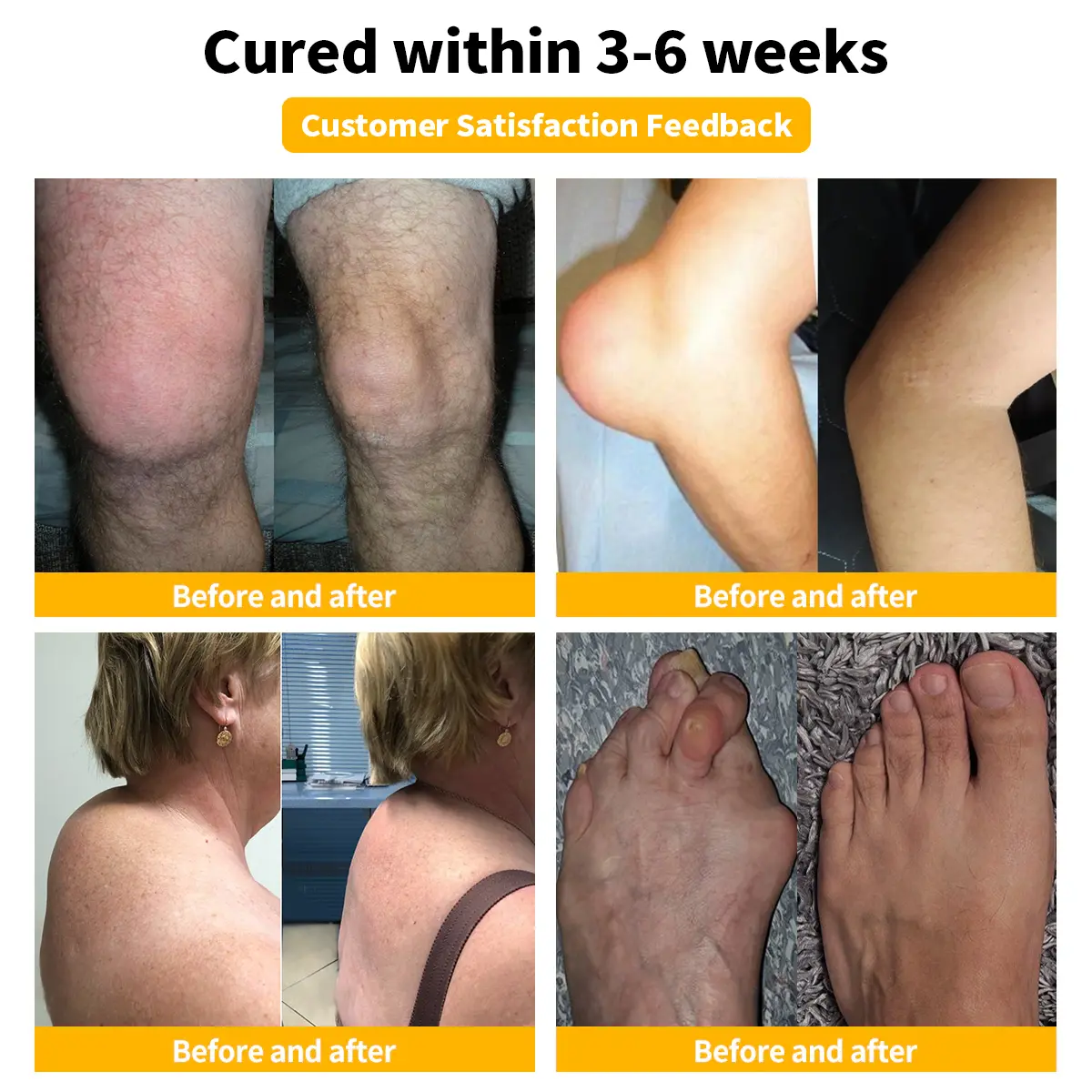 Bee Venom Advanced Joint and Bone Therapy Cream - Image 2