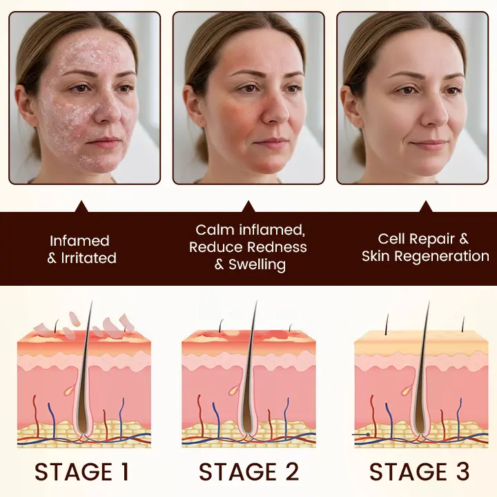 Bee Venom Multi-Repair Cream - Image 4