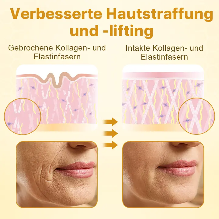 BotoxLux Bienengift Lifting-Creme - Image 4