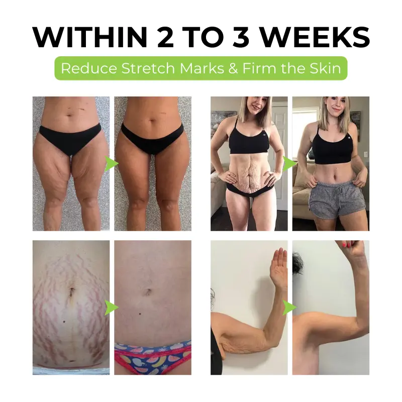 FirmaDerm Collagen Peptide Cream - Image 9