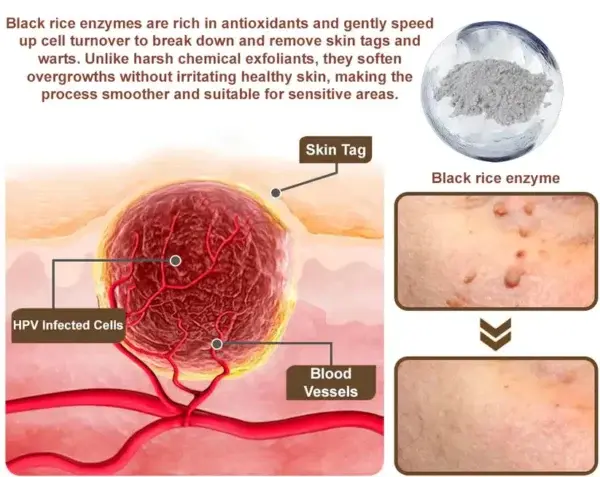 Black Rice Skin Repair Essence Cream