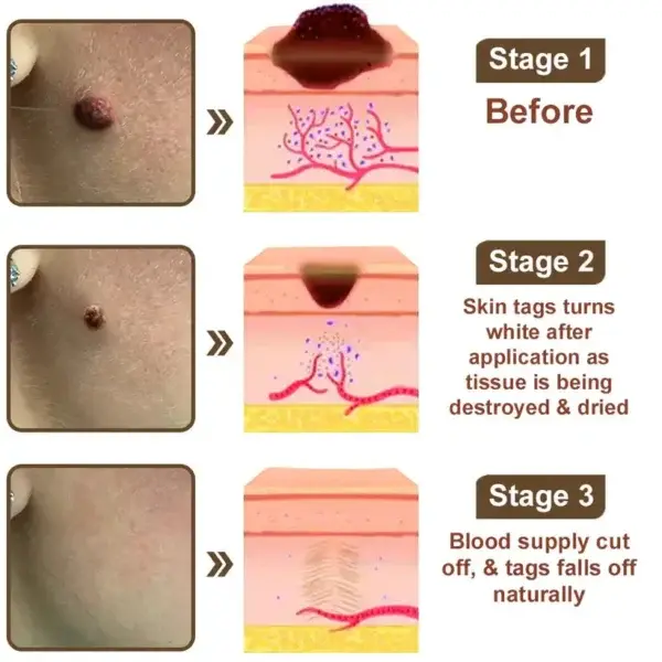 Black Rice Skin Repair Essence Cream