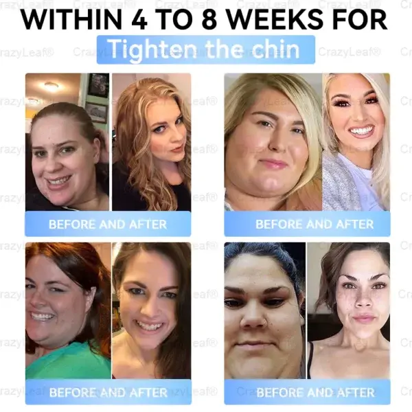 Tirzepatide Slimming & Health Nano Microneedle Patch - Image 10