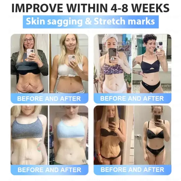 Tirzepatide Slimming & Health Nano Microneedle Patch - Image 8