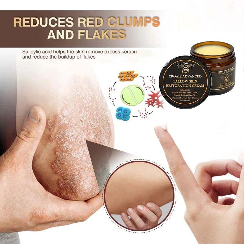 CROAIE ๐๐ฌ๐จ๐ซ๐ข๐๐ฌ๐ข๐ฌ & ๐๐๐ณ๐๐ฆ๐ ๐๐๐ฅ๐ข๐๐ ๐๐ซ๐๐๐ฆ - Image 10