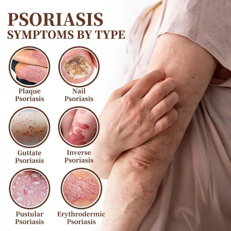 CROAIE ๐๐ฌ๐จ๐ซ๐ข๐๐ฌ๐ข๐ฌ & ๐๐๐ณ๐๐ฆ๐ ๐๐๐ฅ๐ข๐๐ ๐๐ซ๐๐๐ฆ - Image 11