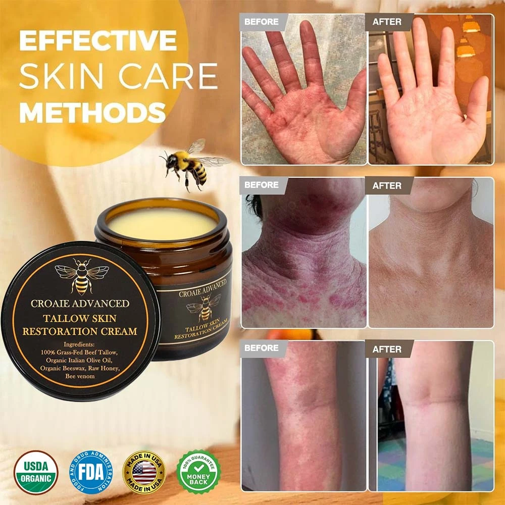 CROAIE ๐๐ฌ๐จ๐ซ๐ข๐๐ฌ๐ข๐ฌ & ๐๐๐ณ๐๐ฆ๐ ๐๐๐ฅ๐ข๐๐ ๐๐ซ๐๐๐ฆ - Image 2