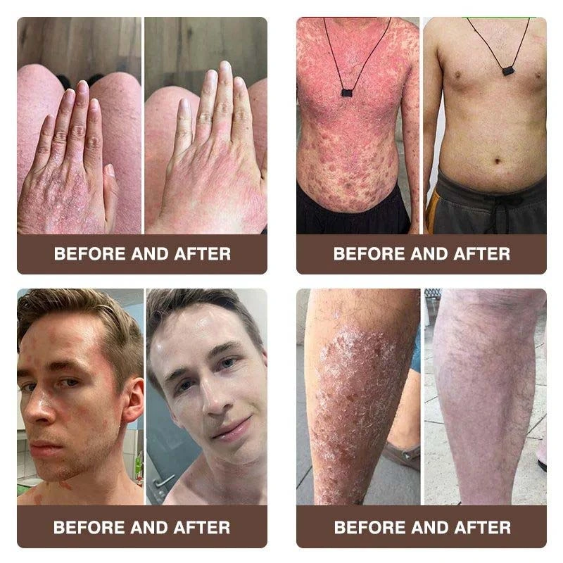 CROAIE ๐๐ฌ๐จ๐ซ๐ข๐๐ฌ๐ข๐ฌ & ๐๐๐ณ๐๐ฆ๐ ๐๐๐ฅ๐ข๐๐ ๐๐ซ๐๐๐ฆ - Image 3