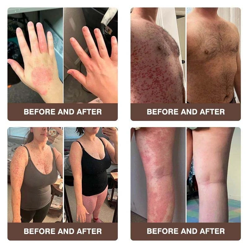 CROAIE ๐๐ฌ๐จ๐ซ๐ข๐๐ฌ๐ข๐ฌ & ๐๐๐ณ๐๐ฆ๐ ๐๐๐ฅ๐ข๐๐ ๐๐ซ๐๐๐ฆ - Image 4